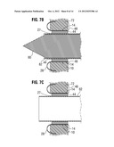 APICAL PUNCTURE ACCESS AND CLOSURE SYSTEM diagram and image