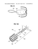 APICAL PUNCTURE ACCESS AND CLOSURE SYSTEM diagram and image