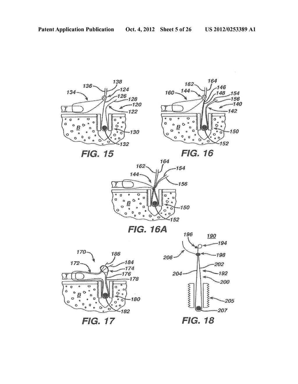 SURGICAL FILAMENT SNARE ASSEMBLIES - diagram, schematic, and image 06