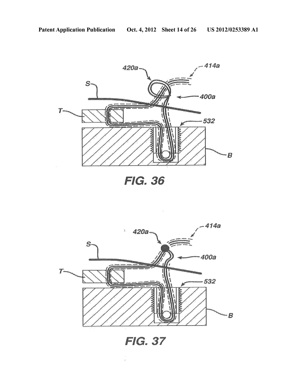 SURGICAL FILAMENT SNARE ASSEMBLIES - diagram, schematic, and image 15