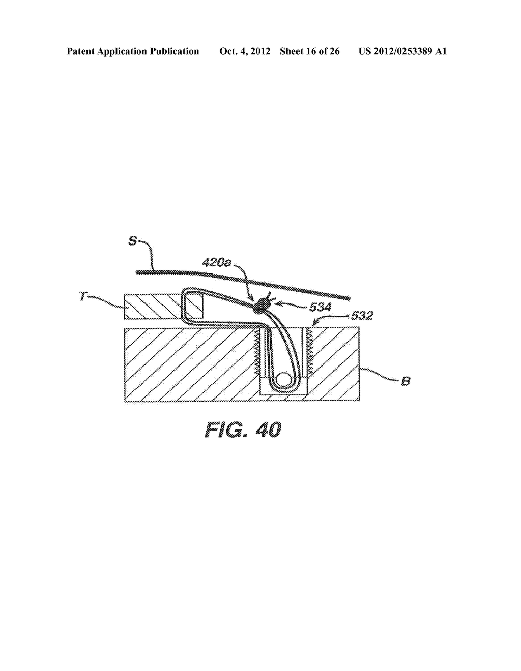 SURGICAL FILAMENT SNARE ASSEMBLIES - diagram, schematic, and image 17