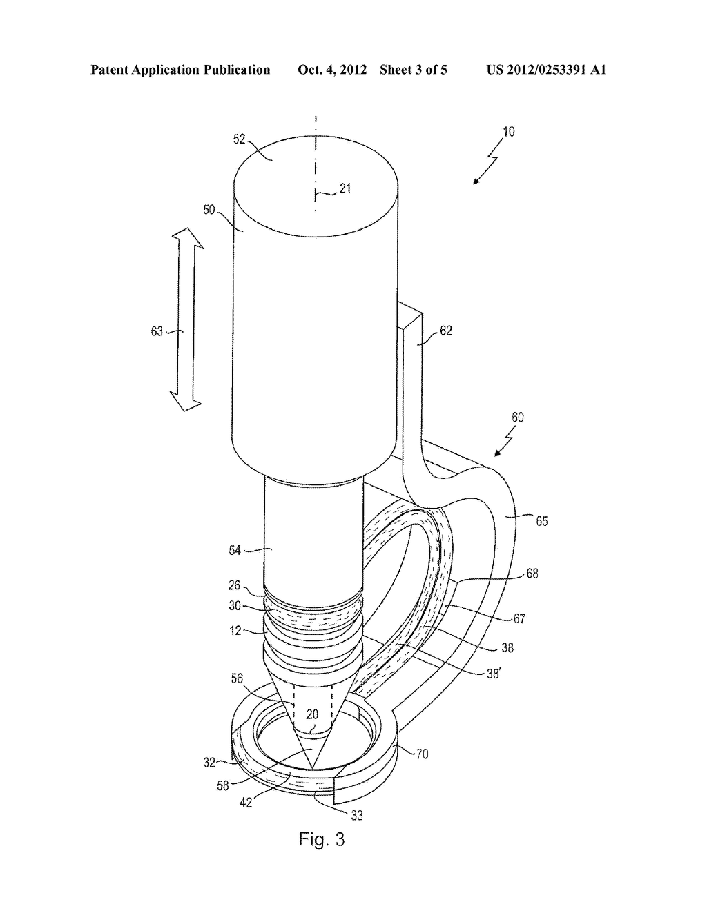 Instrument Kit For Knotless Fixing Of Tissue To A Bone - diagram, schematic, and image 04