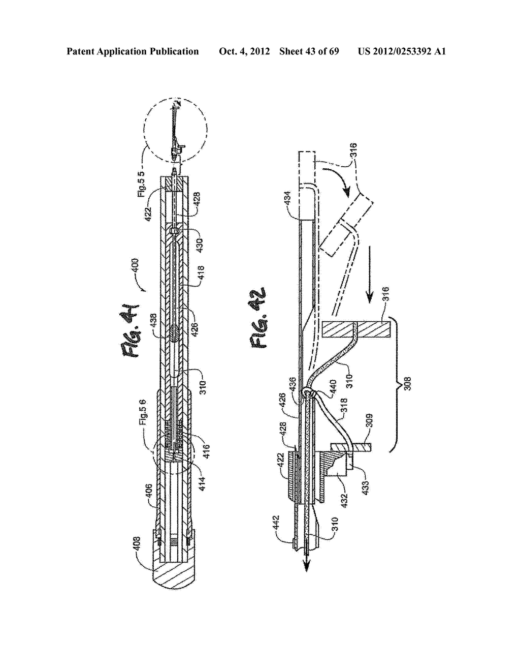 METHOD AND APPARATUS FOR THE TREATMENT OF TISSUE - diagram, schematic, and image 44