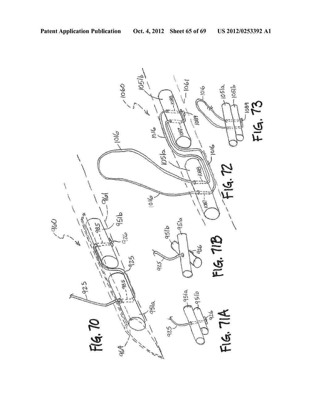 METHOD AND APPARATUS FOR THE TREATMENT OF TISSUE - diagram, schematic, and image 66