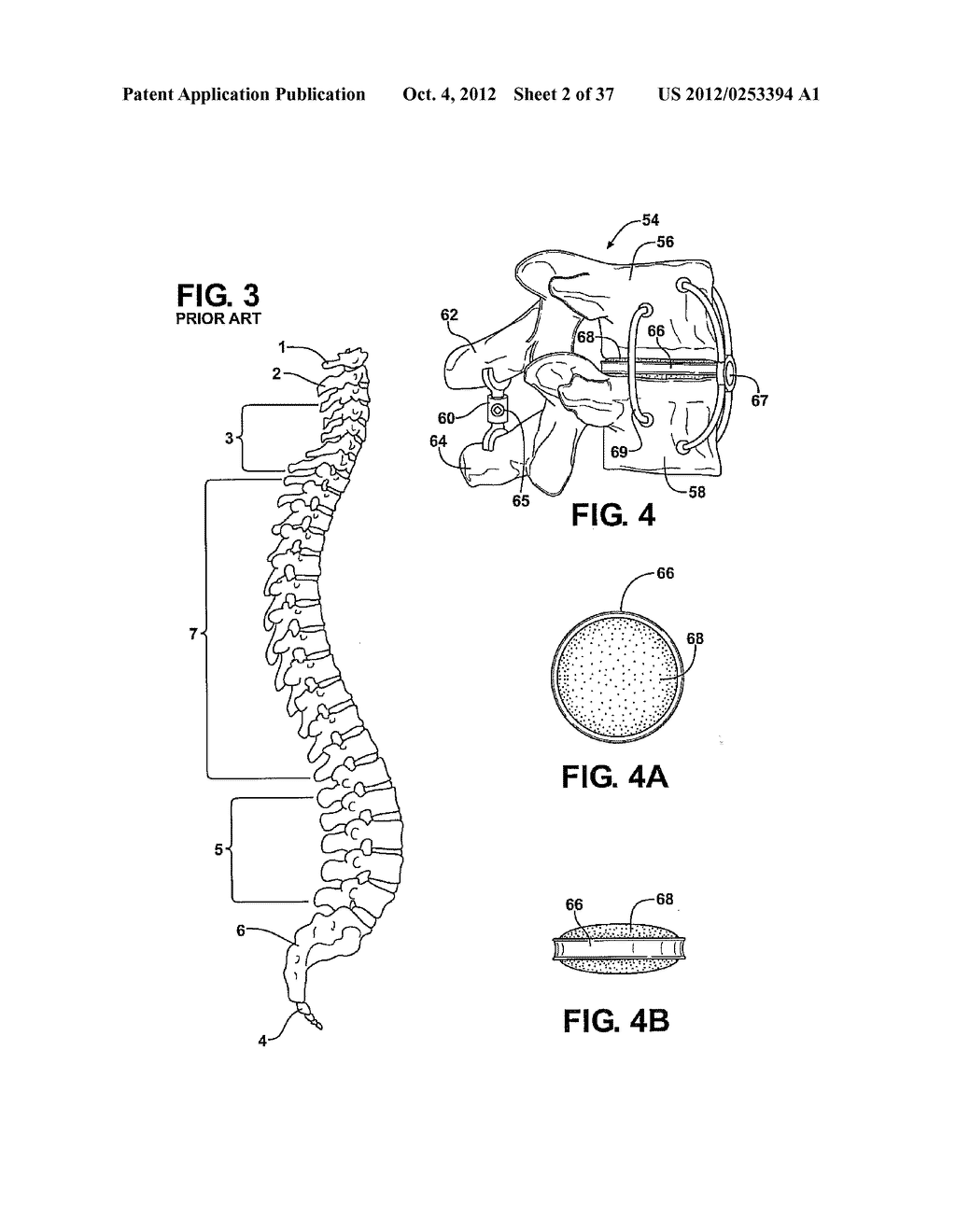 ONE AND TWO PIECE SPINAL JACK INCORPORATING VARYING MECHANICAL PIVOT,     HINGE AND CAM LIFT CONSTRUCTIONS FOR ESTABLISHING A DESIRED SPACING     BETWEEN SUCCEEDING VERTEBRAE - diagram, schematic, and image 03