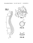 TWO PIECE SPINAL JACK INCORPORATING VARYING MECHANICAL AND FLUIDIC LIFT     MECHANISMS FOR ESTABLISHING A DESIRED SPACING BETWEEN SUCCEEDING     VERTEBRAE diagram and image