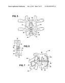 TWO PIECE SPINAL JACK INCORPORATING VARYING MECHANICAL AND FLUIDIC LIFT     MECHANISMS FOR ESTABLISHING A DESIRED SPACING BETWEEN SUCCEEDING     VERTEBRAE diagram and image