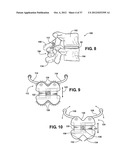 TWO PIECE SPINAL JACK INCORPORATING VARYING MECHANICAL AND FLUIDIC LIFT     MECHANISMS FOR ESTABLISHING A DESIRED SPACING BETWEEN SUCCEEDING     VERTEBRAE diagram and image