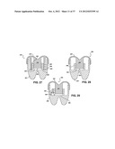 TWO PIECE SPINAL JACK INCORPORATING VARYING MECHANICAL AND FLUIDIC LIFT     MECHANISMS FOR ESTABLISHING A DESIRED SPACING BETWEEN SUCCEEDING     VERTEBRAE diagram and image