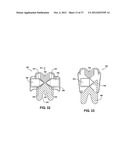 TWO PIECE SPINAL JACK INCORPORATING VARYING MECHANICAL AND FLUIDIC LIFT     MECHANISMS FOR ESTABLISHING A DESIRED SPACING BETWEEN SUCCEEDING     VERTEBRAE diagram and image