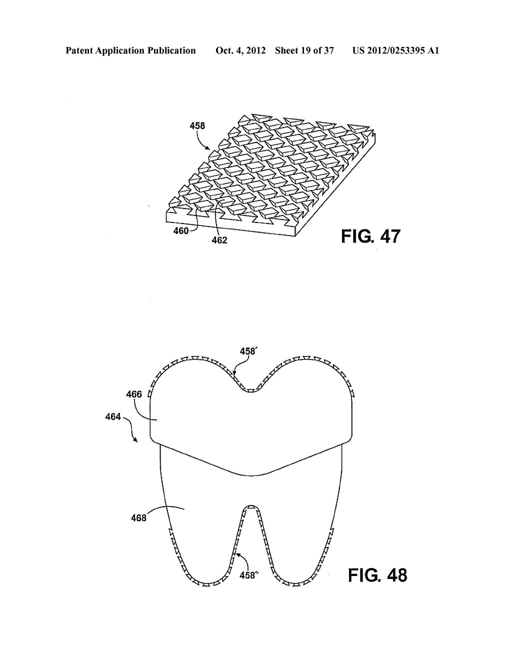 TWO PIECE SPINAL JACK INCORPORATING VARYING MECHANICAL AND FLUIDIC LIFT     MECHANISMS FOR ESTABLISHING A DESIRED SPACING BETWEEN SUCCEEDING     VERTEBRAE - diagram, schematic, and image 20