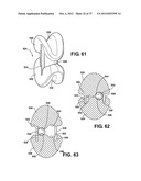 TWO PIECE SPINAL JACK INCORPORATING VARYING MECHANICAL AND FLUIDIC LIFT     MECHANISMS FOR ESTABLISHING A DESIRED SPACING BETWEEN SUCCEEDING     VERTEBRAE diagram and image