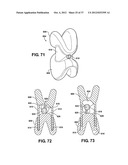 TWO PIECE SPINAL JACK INCORPORATING VARYING MECHANICAL AND FLUIDIC LIFT     MECHANISMS FOR ESTABLISHING A DESIRED SPACING BETWEEN SUCCEEDING     VERTEBRAE diagram and image