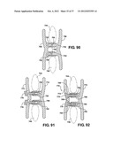 TWO PIECE SPINAL JACK INCORPORATING VARYING MECHANICAL AND FLUIDIC LIFT     MECHANISMS FOR ESTABLISHING A DESIRED SPACING BETWEEN SUCCEEDING     VERTEBRAE diagram and image