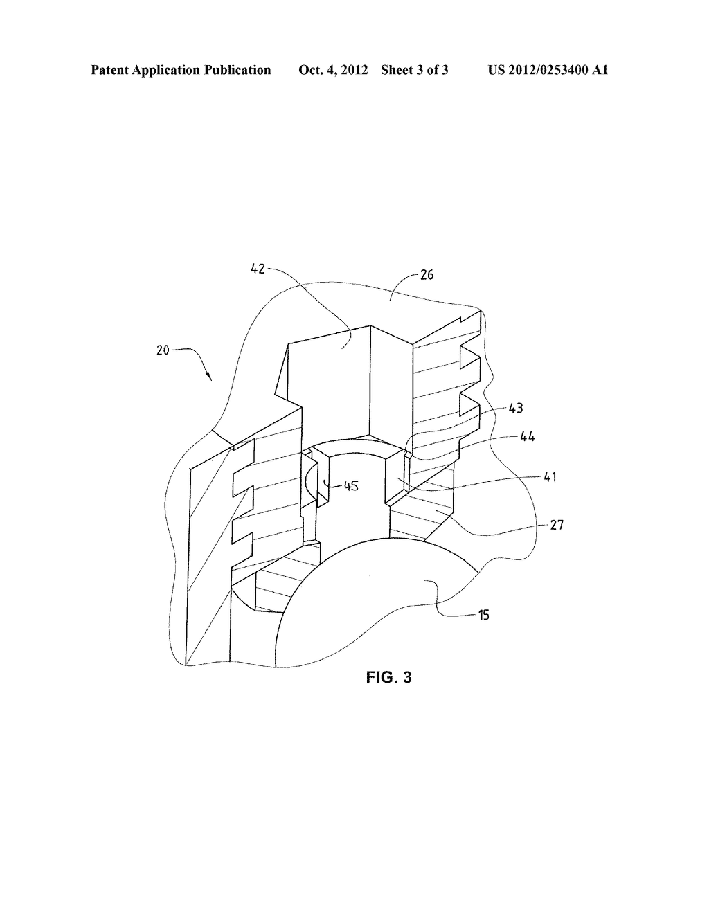 VERTEBRAL COLUMN IMPLANT - diagram, schematic, and image 04