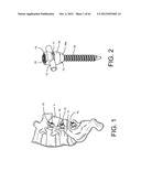 PEDICLE SCREW EXTENSION FOR USE IN PERCUTANEOUS SPINAL FIXATION diagram and image