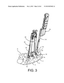 PEDICLE SCREW EXTENSION FOR USE IN PERCUTANEOUS SPINAL FIXATION diagram and image