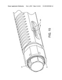 PEDICLE SCREW EXTENSION FOR USE IN PERCUTANEOUS SPINAL FIXATION diagram and image