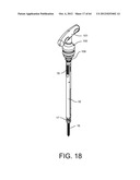 PEDICLE SCREW EXTENSION FOR USE IN PERCUTANEOUS SPINAL FIXATION diagram and image