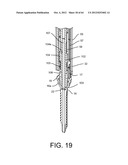 PEDICLE SCREW EXTENSION FOR USE IN PERCUTANEOUS SPINAL FIXATION diagram and image