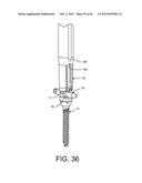 PEDICLE SCREW EXTENSION FOR USE IN PERCUTANEOUS SPINAL FIXATION diagram and image