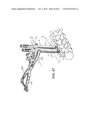 PEDICLE SCREW EXTENSION FOR USE IN PERCUTANEOUS SPINAL FIXATION diagram and image