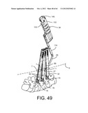 PEDICLE SCREW EXTENSION FOR USE IN PERCUTANEOUS SPINAL FIXATION diagram and image