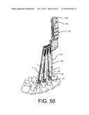 PEDICLE SCREW EXTENSION FOR USE IN PERCUTANEOUS SPINAL FIXATION diagram and image