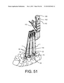 PEDICLE SCREW EXTENSION FOR USE IN PERCUTANEOUS SPINAL FIXATION diagram and image