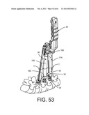 PEDICLE SCREW EXTENSION FOR USE IN PERCUTANEOUS SPINAL FIXATION diagram and image