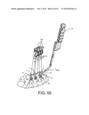 PEDICLE SCREW EXTENSION FOR USE IN PERCUTANEOUS SPINAL FIXATION diagram and image