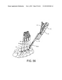 PEDICLE SCREW EXTENSION FOR USE IN PERCUTANEOUS SPINAL FIXATION diagram and image