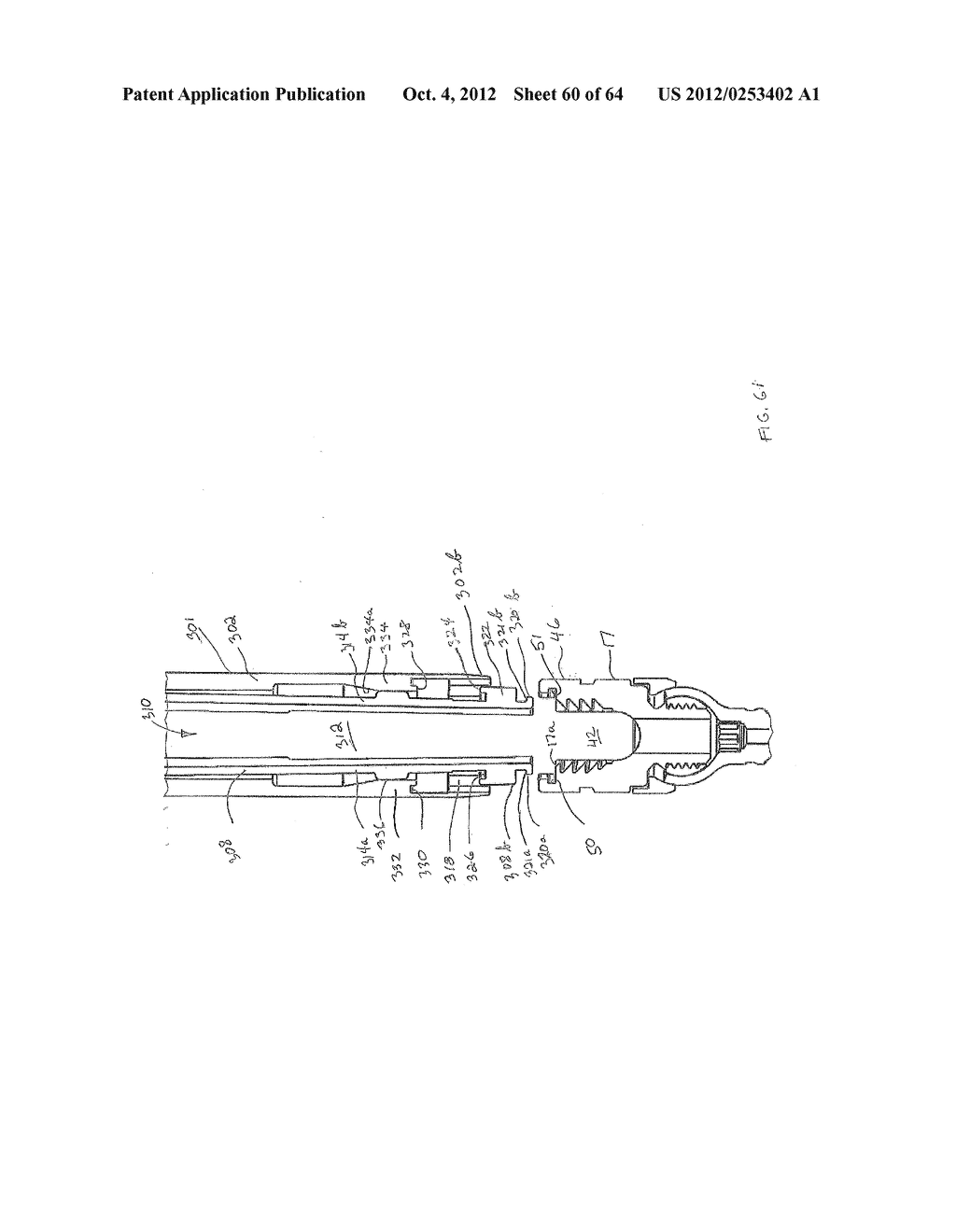 PEDICLE SCREW EXTENSION FOR USE IN PERCUTANEOUS SPINAL FIXATION - diagram, schematic, and image 61