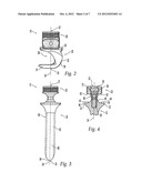 SPINAL FIXATION SYSTEM diagram and image