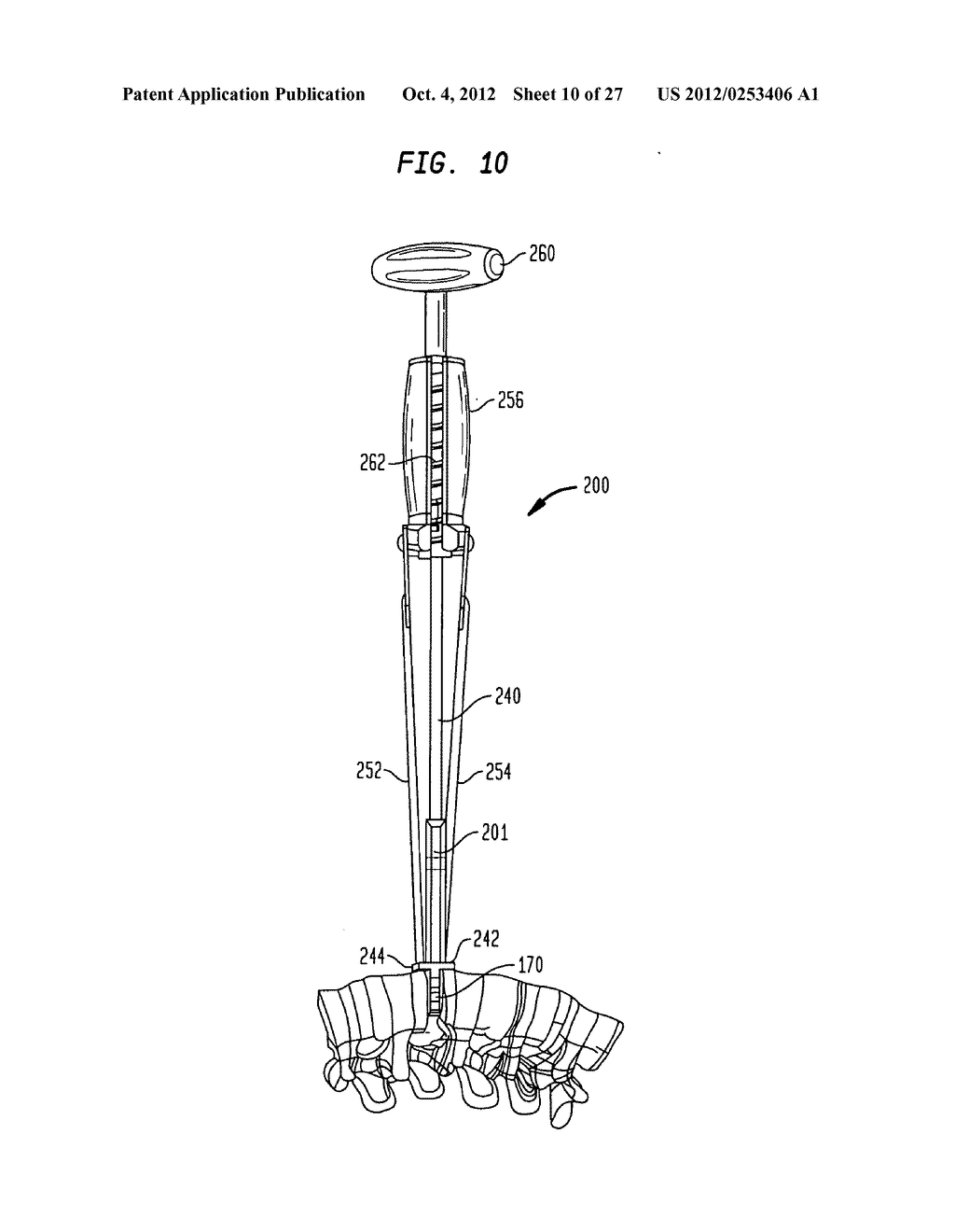 INTERVERTEBRAL IMPLANT WITH INTEGRATED FIXATION - diagram, schematic, and image 11