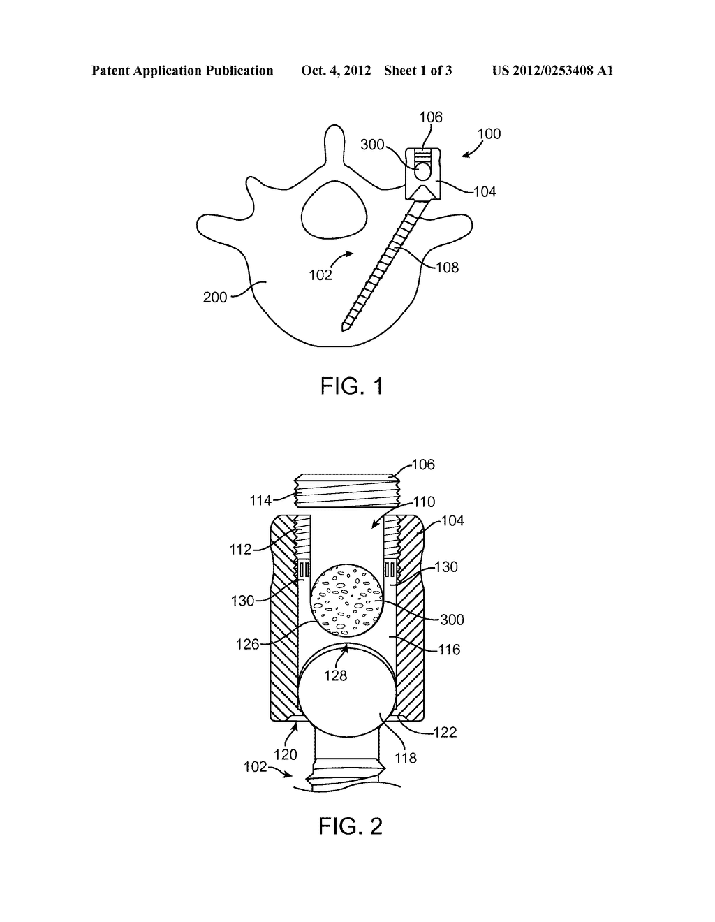 SCREW ASSEMBLY WITH DEFORMABLE BUSHING - diagram, schematic, and image 02