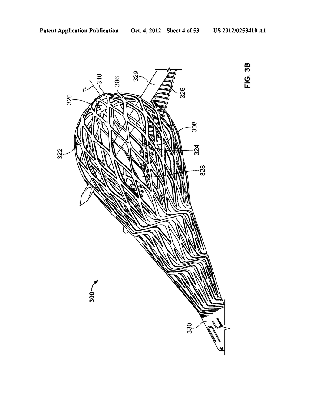 APPARATUS AND METHODS FOR BONE REPAIR PREPARATION - diagram, schematic, and image 05