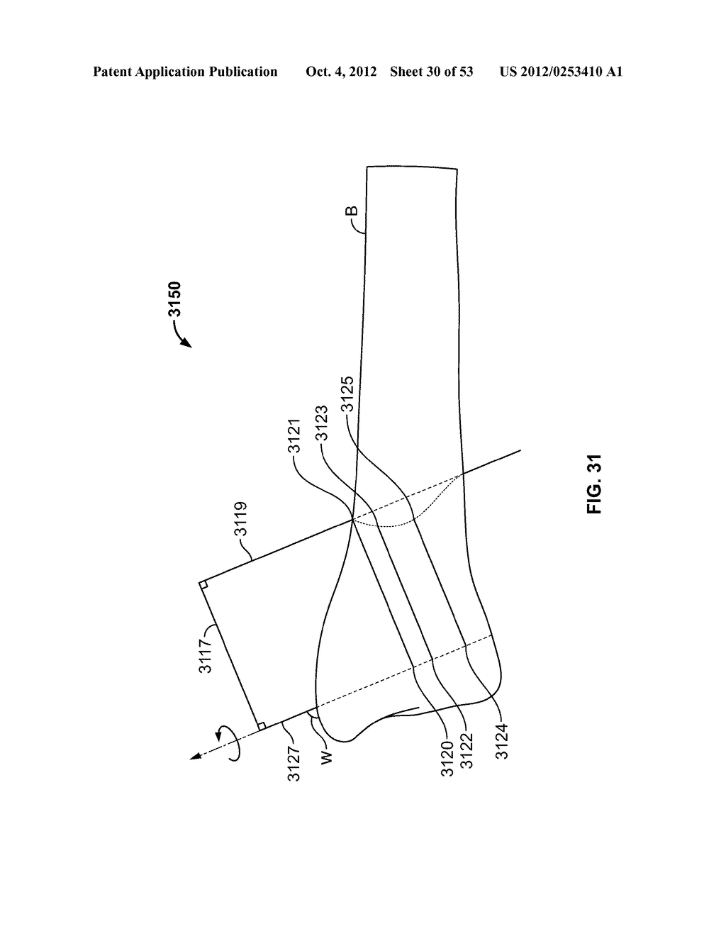 APPARATUS AND METHODS FOR BONE REPAIR PREPARATION - diagram, schematic, and image 31