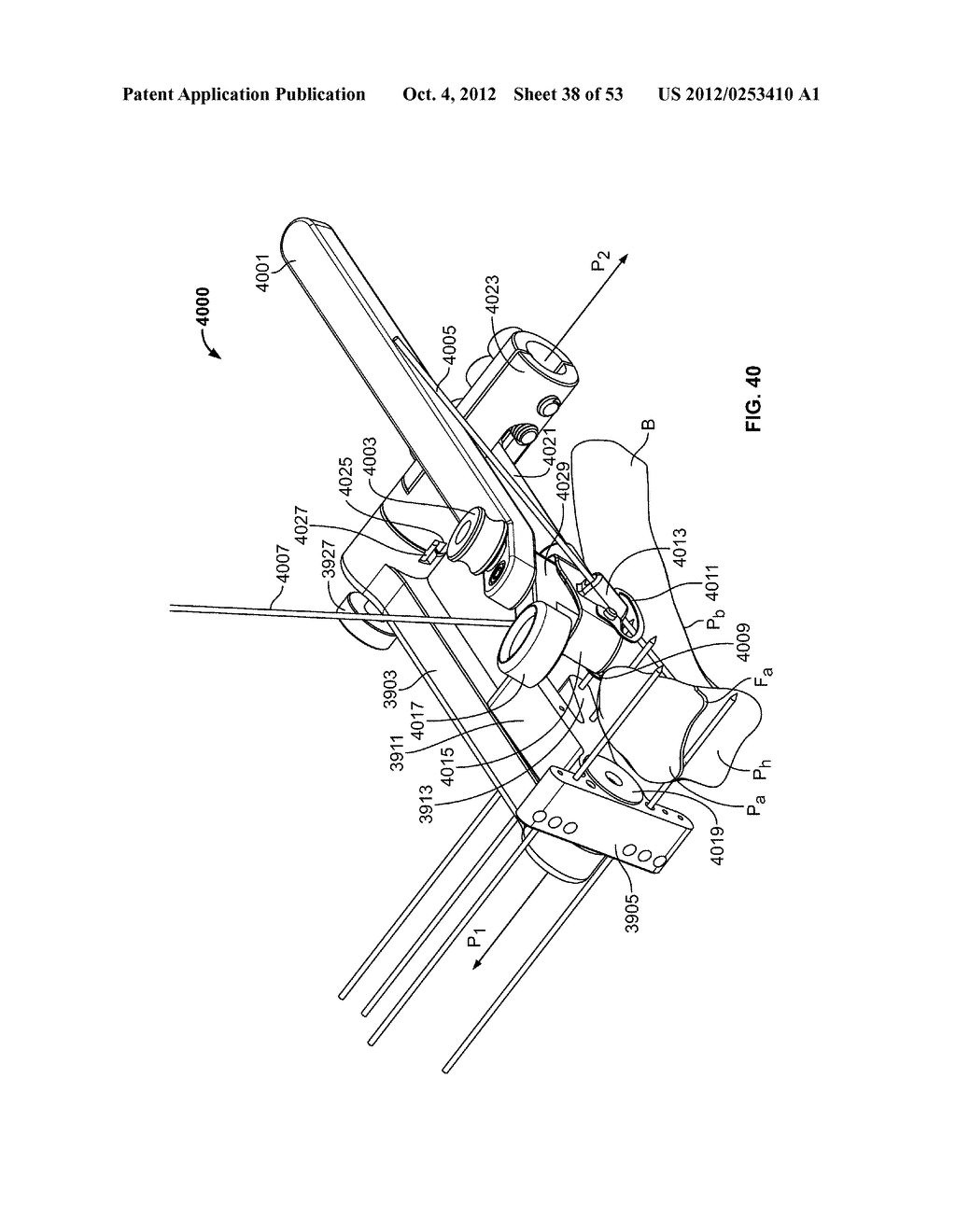 APPARATUS AND METHODS FOR BONE REPAIR PREPARATION - diagram, schematic, and image 39