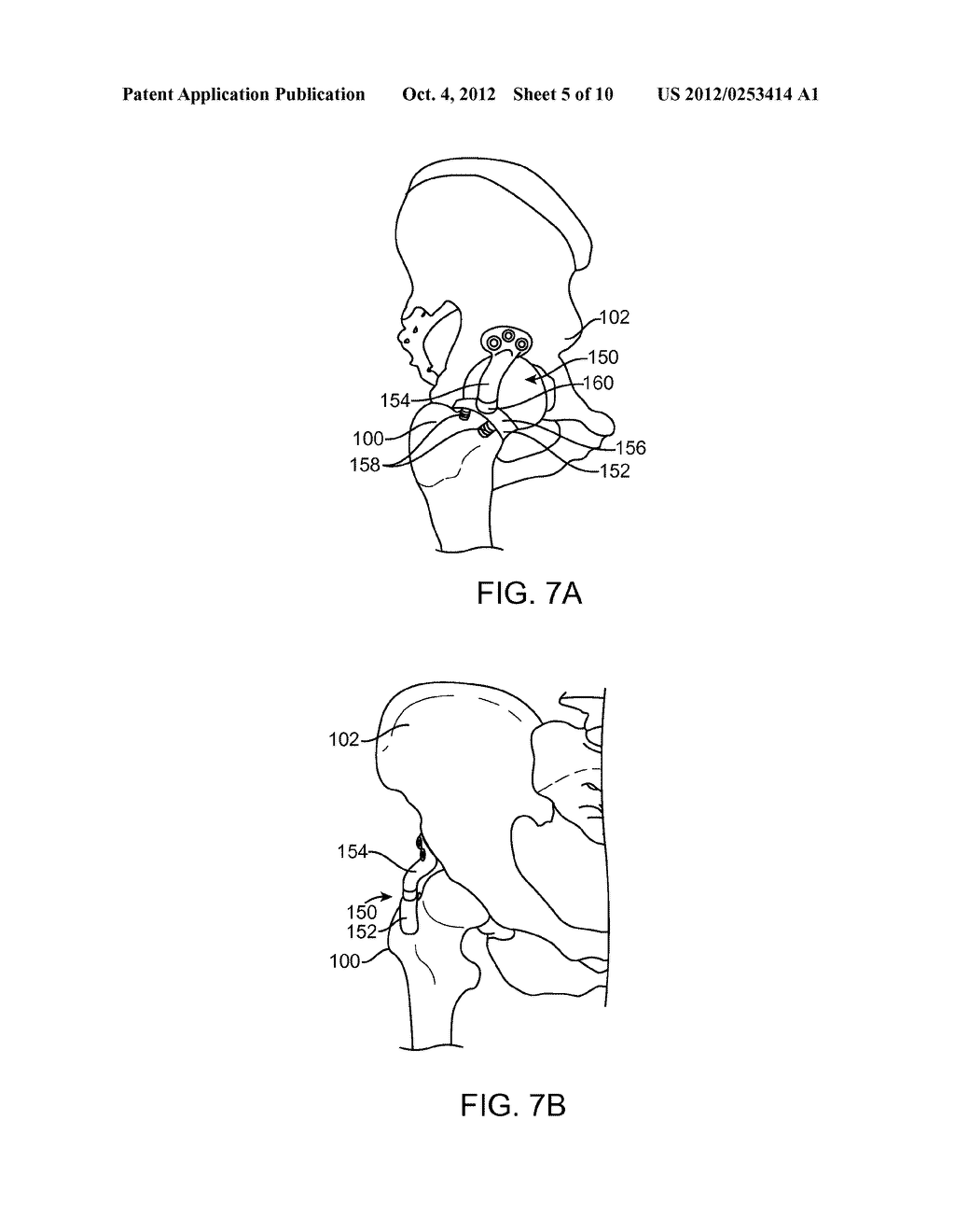 Apparatus For Controlling a Load on a Hip Joint - diagram, schematic, and image 06