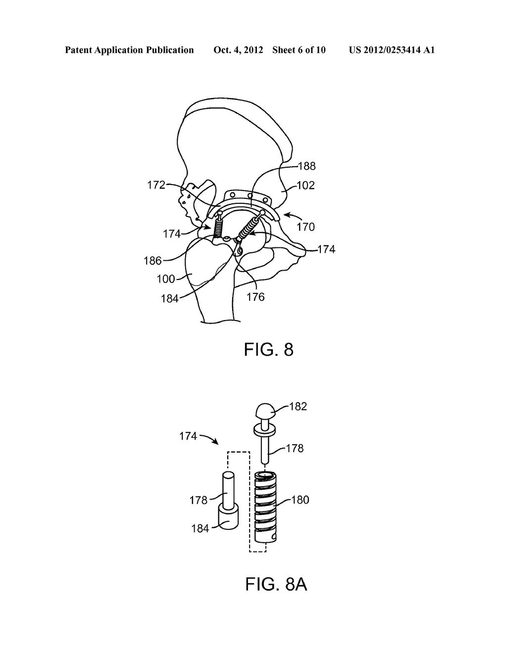 Apparatus For Controlling a Load on a Hip Joint - diagram, schematic, and image 07