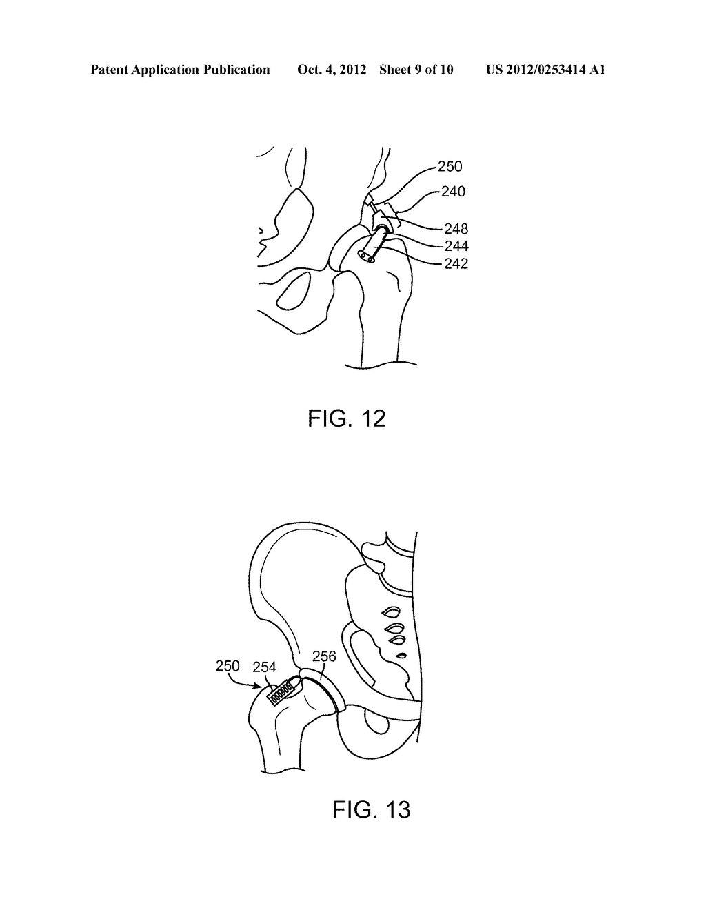 Apparatus For Controlling a Load on a Hip Joint - diagram, schematic, and image 10