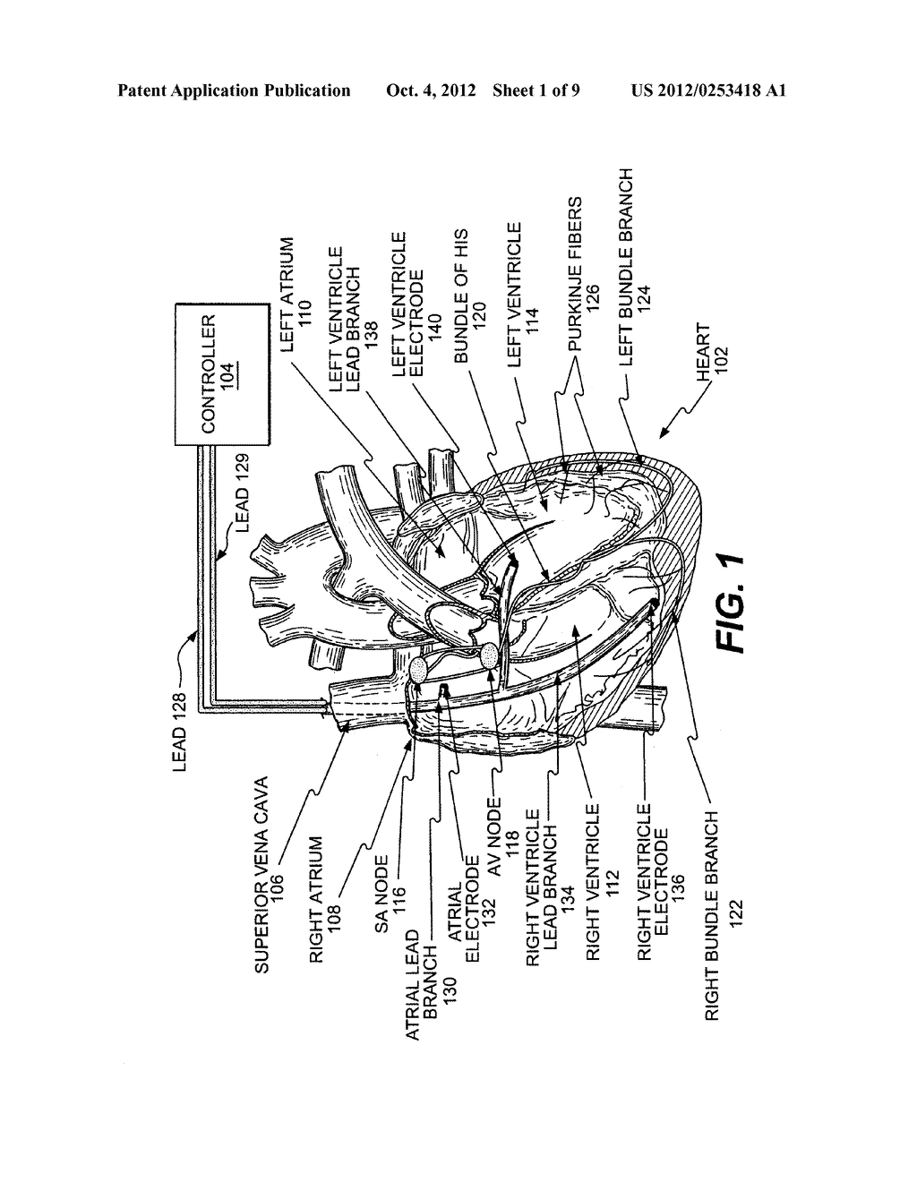 METHODS, APPARATUS, AND SYSTEMS FOR MULTIPLE STIMULATION FROM A SINGLE     STIMULATOR - diagram, schematic, and image 02