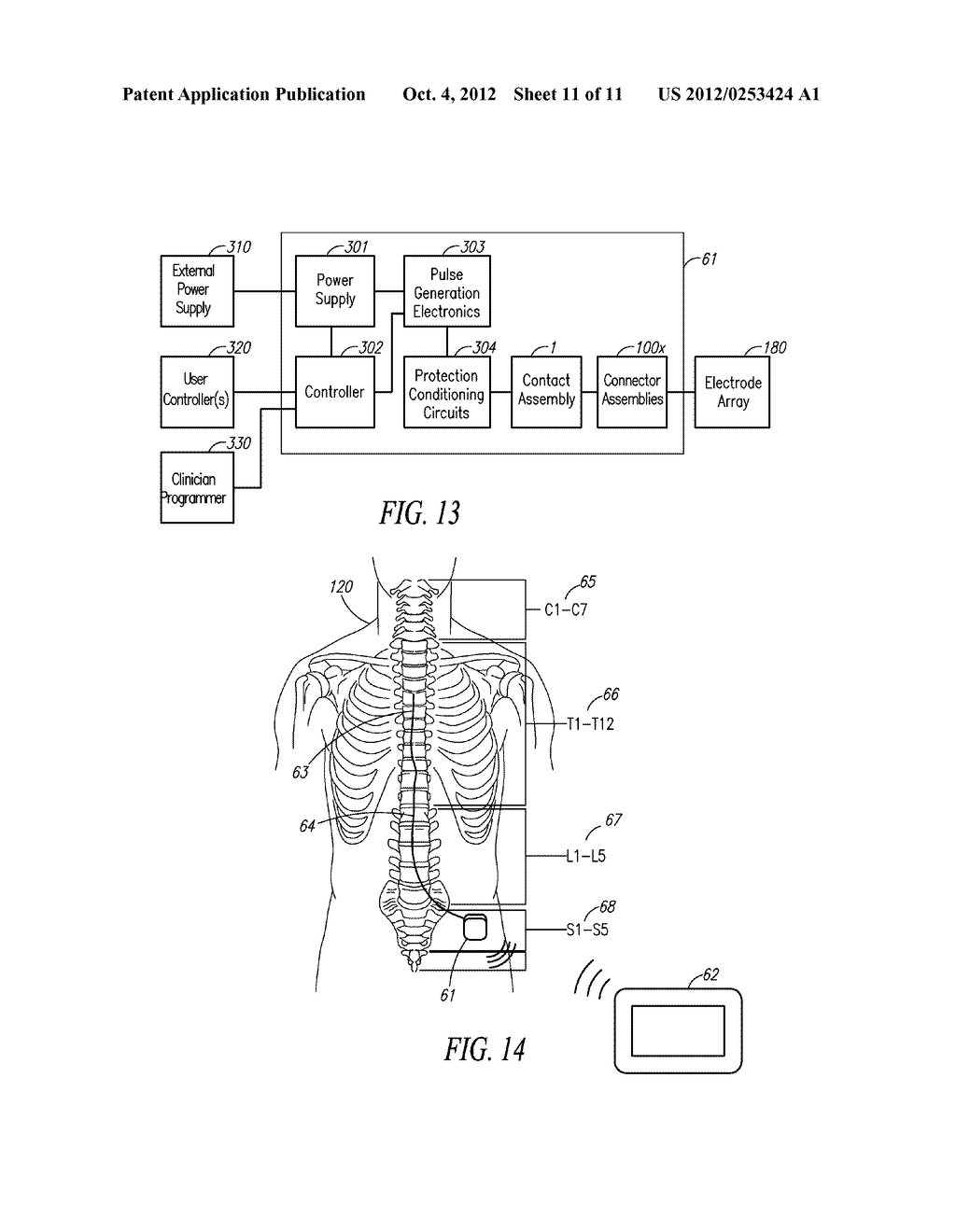 FEED-THROUGH CONNECTOR ASSEMBLY FOR IMPLANTABLE PULSE GENERATOR AND METHOD     OF USE - diagram, schematic, and image 12