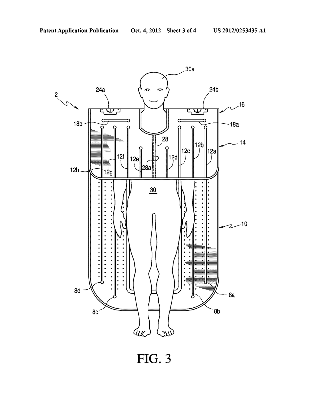 Combination Underbody and Overbody Blanket - diagram, schematic, and image 04