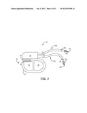 COUPLING MECHANISMS FOR USE WITH A MEDICAL ELECTRICAL LEAD diagram and image