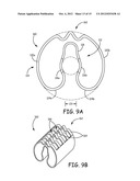 COUPLING MECHANISMS FOR USE WITH A MEDICAL ELECTRICAL LEAD diagram and image