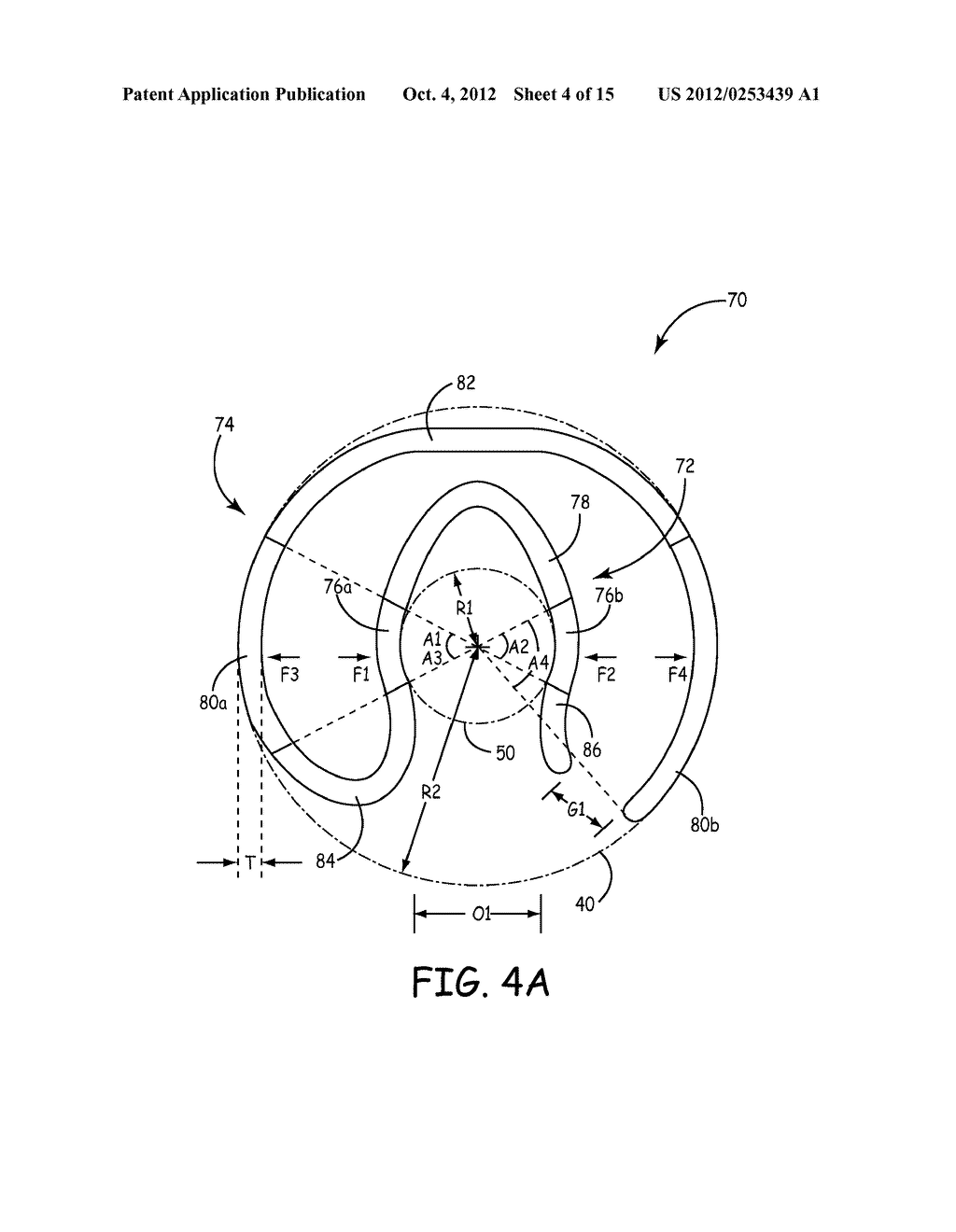 COUPLING MECHANISMS FOR USE WITH A MEDICAL ELECTRICAL LEAD - diagram, schematic, and image 05