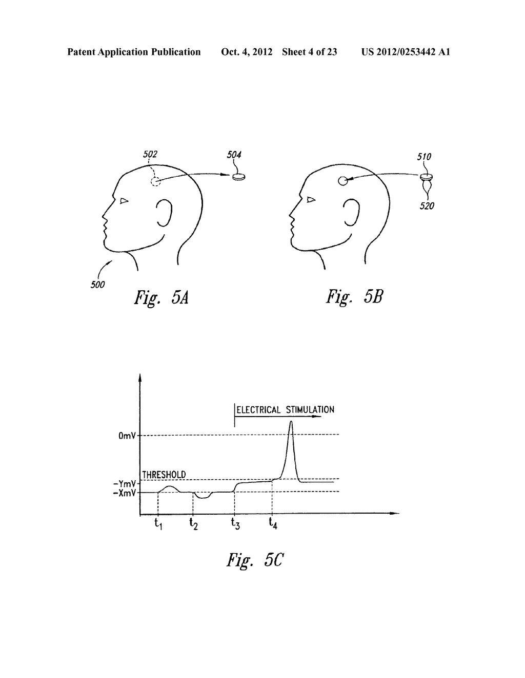 METHODS AND APPARATUS FOR EFFECTUATING A LASTING CHANGE IN A     NEURAL-FUNCTION OF A PATIENT - diagram, schematic, and image 05