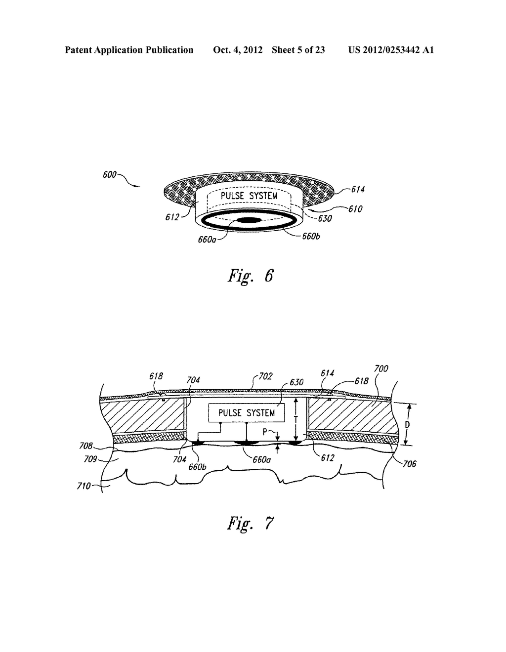 METHODS AND APPARATUS FOR EFFECTUATING A LASTING CHANGE IN A     NEURAL-FUNCTION OF A PATIENT - diagram, schematic, and image 06